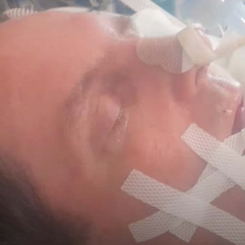 Mann auf Intensivstation