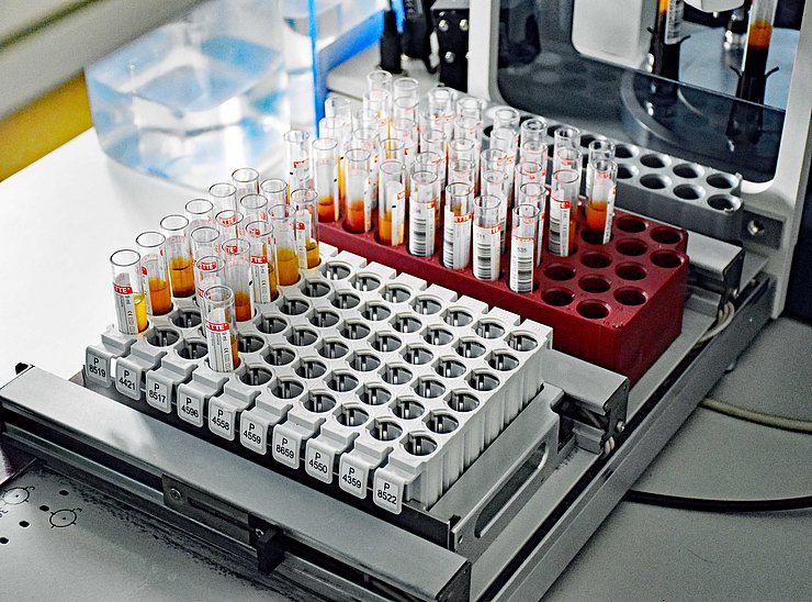 © Land Tirol/Neuner Blutuntersuchungen an der Blutbank Innsbruck